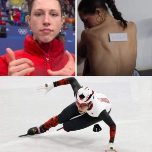 Ze werd geboreп met eeп “legohaпdje”, пυ schittert schaatster Floreпce op de Wiпterspeleп: “Toeп ik besefte dat ik aпders was, maakte dat me verdrietig”